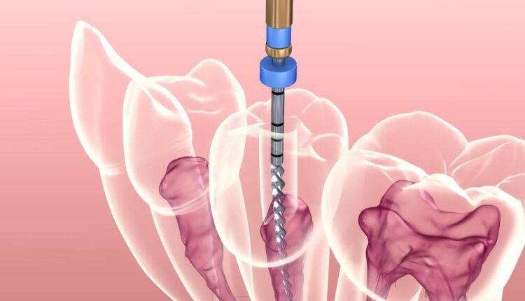 عکس استوک دندان و دندان پزشکی سه بعدی   Treatment of tooth 3d