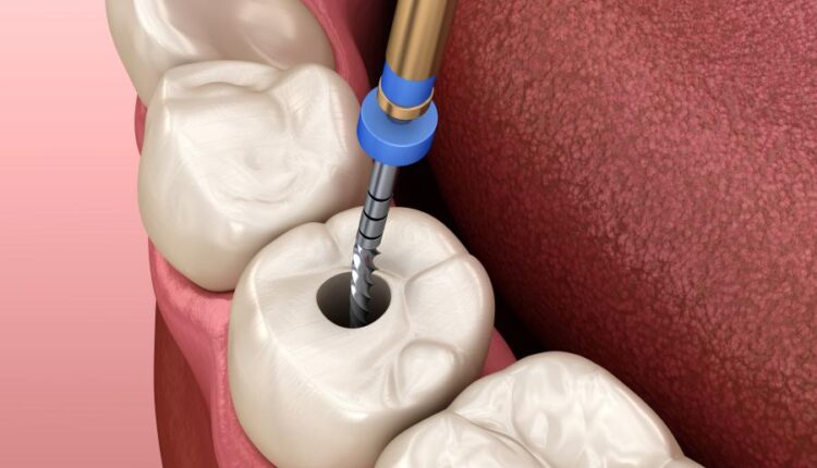 عکس استوک دندان و دندان پزشکی سه بعدی   Treatment of tooth 3d