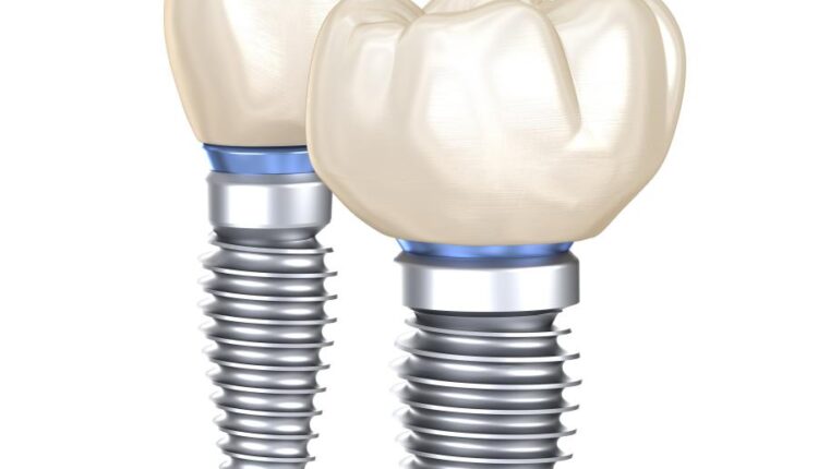 عکس استوک دندان و دندان پزشکی سه بعدی   Treatment of tooth 3d