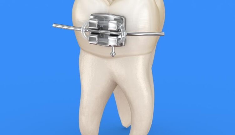 عکس استوک دندان و دندان پزشکی سه بعدی   Treatment of tooth 3d