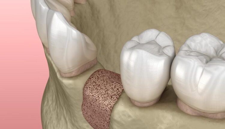 عکس استوک دندان و دندان پزشکی سه بعدی   Treatment of tooth 3d